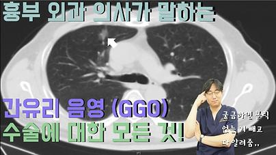  GGO, 수술을 고민한다면? 간유리음영 / GGO 